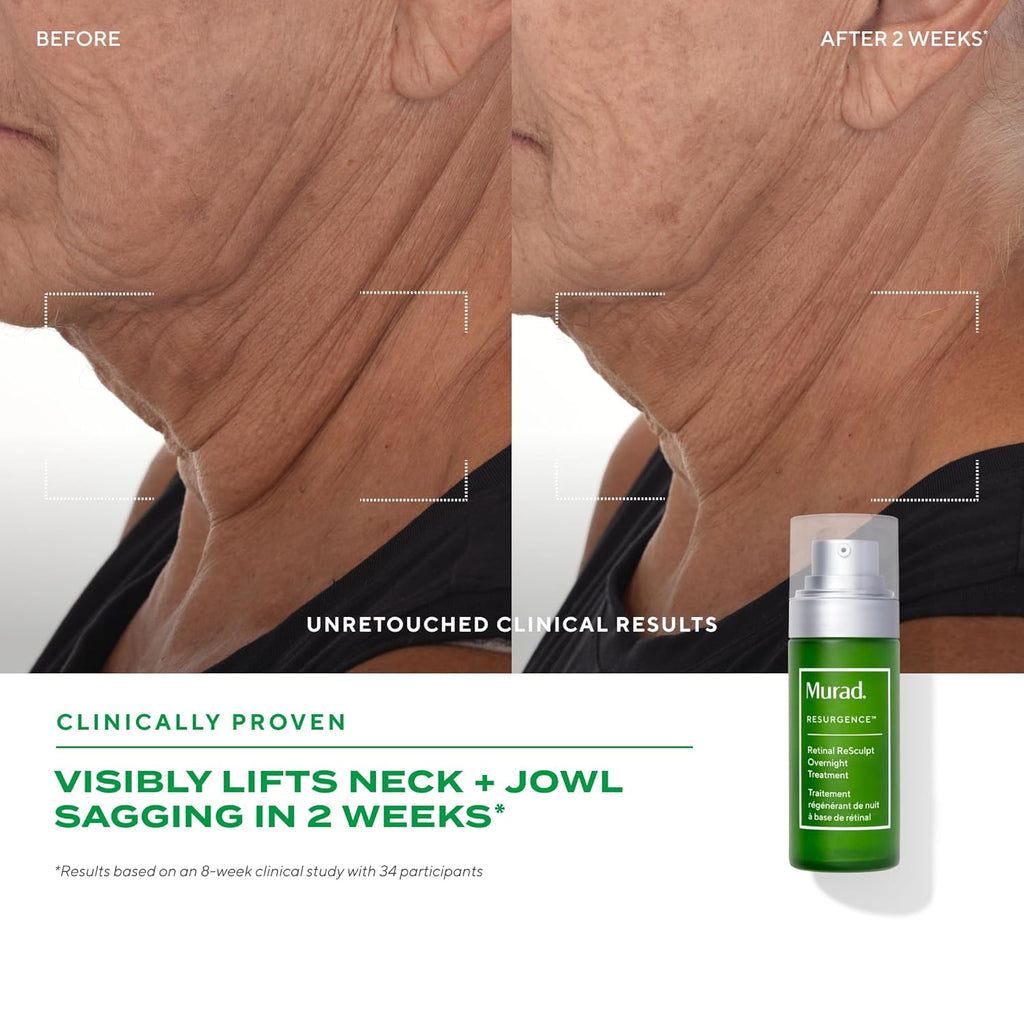 Murad Retinal ReSculpt Overnight Treatment - Advanced Face and Neck Serum with Encapsulated Retinal, Kangaroo Paw, Olive, & Oat Smooths Deep Wrinkles and Crepey Skin, & Lifts Sagging Skin