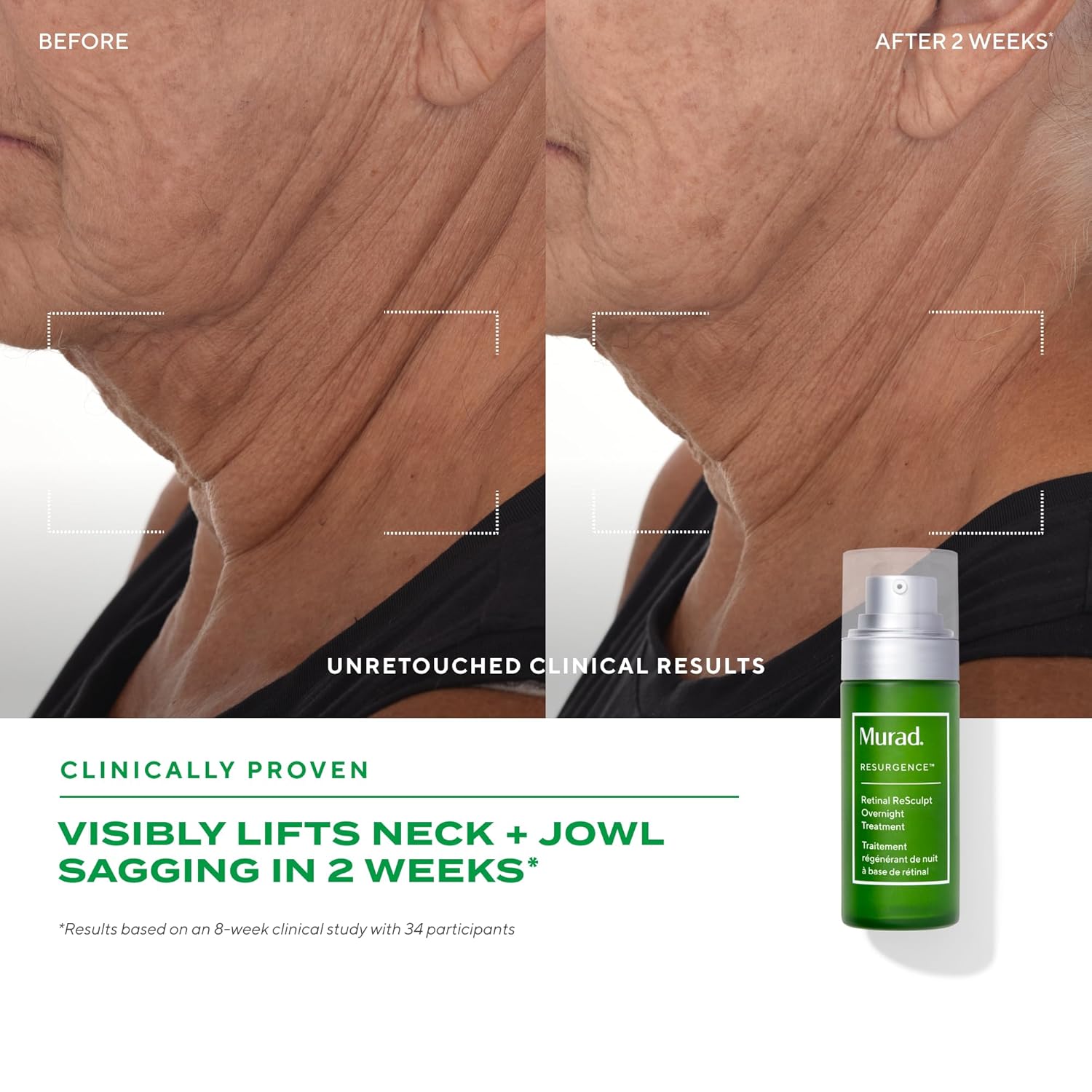 Murad Retinal ReSculpt Overnight Treatment - Advanced Face and Neck Serum with Encapsulated Retinal, Kangaroo Paw, Olive, & Oat Smooths Deep Wrinkles and Crepey Skin, & Lifts Sagging Skin