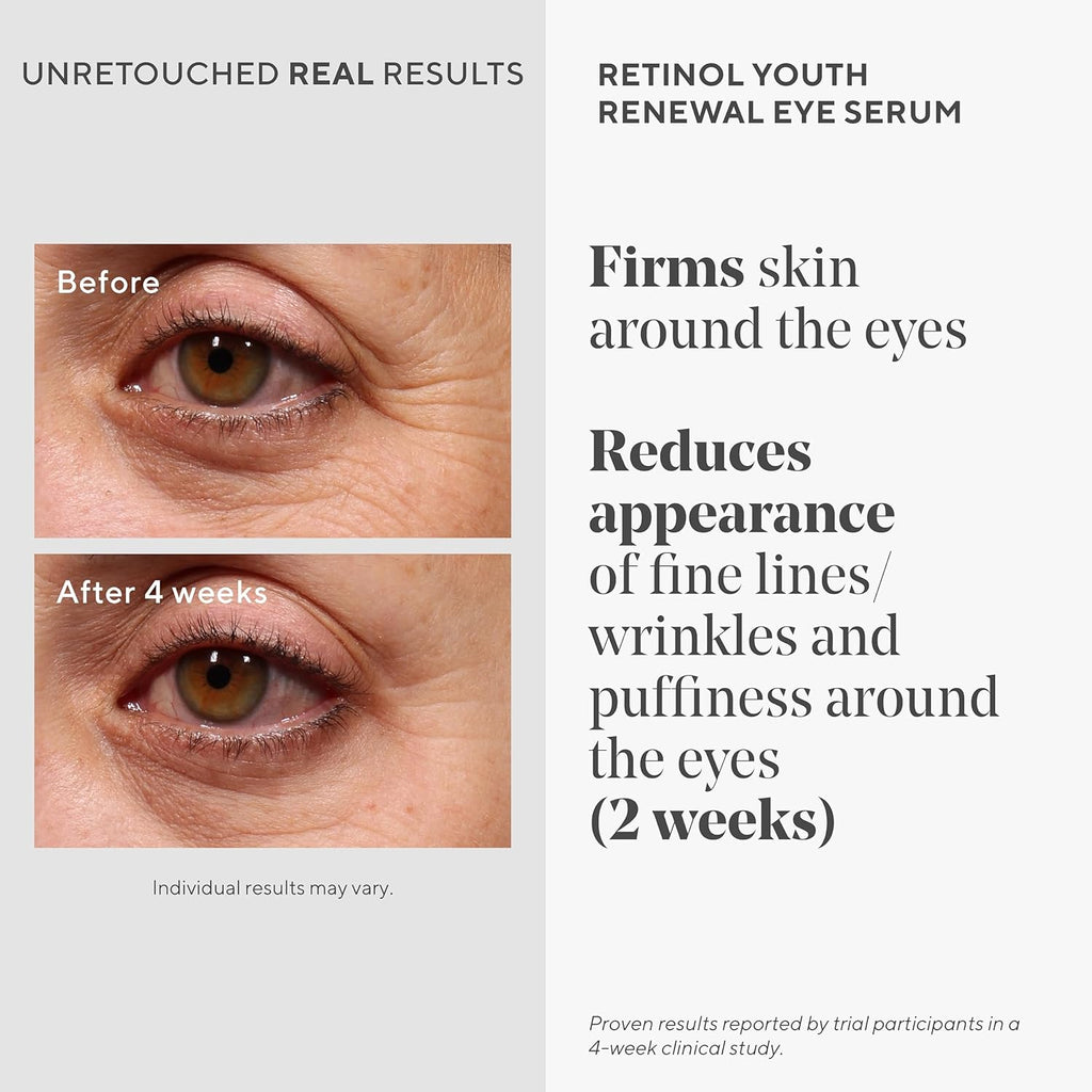 Murad Retinol Youth Renewal Eye Serum - Retinol Eye Serum Visibly Improves Undereye Puffiness Dark Circles and Reduces the Appearance of Fine Lines, Gentle Enough for Nightly Use - 0.5 oz