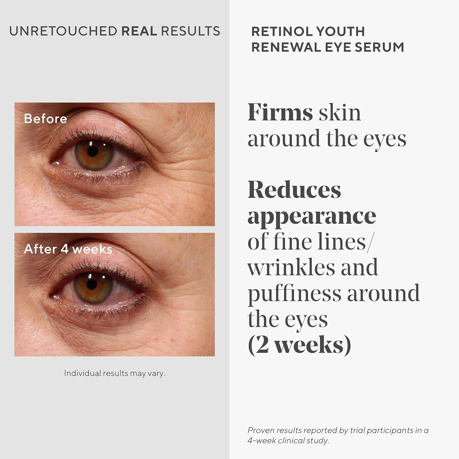 Murad Retinol Youth Renewal Eye Serum - Retinol Eye Serum Visibly Improves Undereye Puffiness Dark Circles and Reduces the Appearance of Fine Lines, Gentle Enough for Nightly Use - 0.5 oz