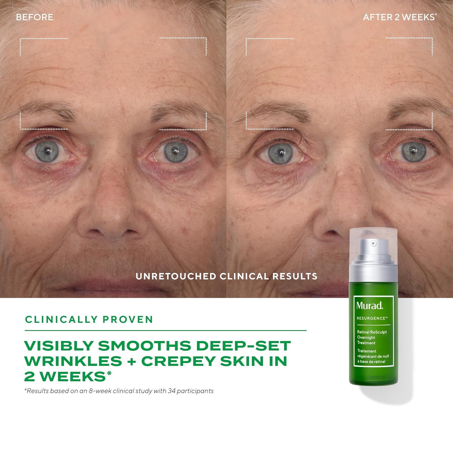 Murad Retinal ReSculpt Overnight Treatment - Advanced Face and Neck Serum with Encapsulated Retinal, Kangaroo Paw, Olive, & Oat Smooths Deep Wrinkles and Crepey Skin, & Lifts Sagging Skin